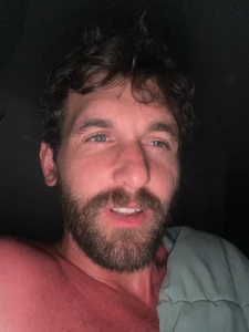 I got burnt by the sun today