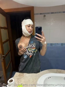 Surgery was a success i ll be back sucking dick soon