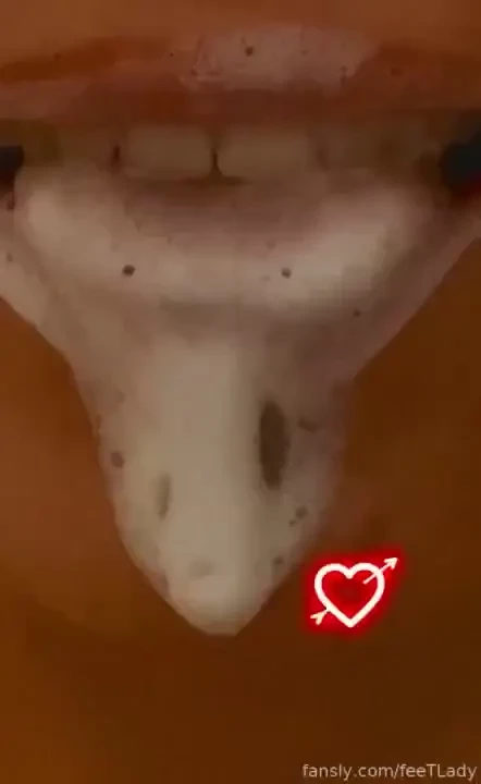 Good morning saliva spit 