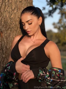 First photoshoot after surgery look how it all turned out i m happy