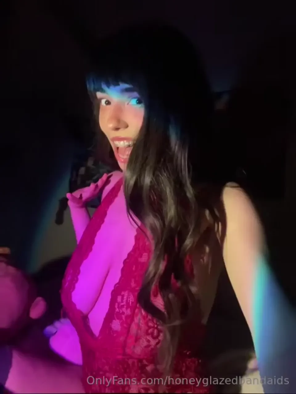 Throwback to when i had my braces 0 