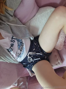 Openlegs