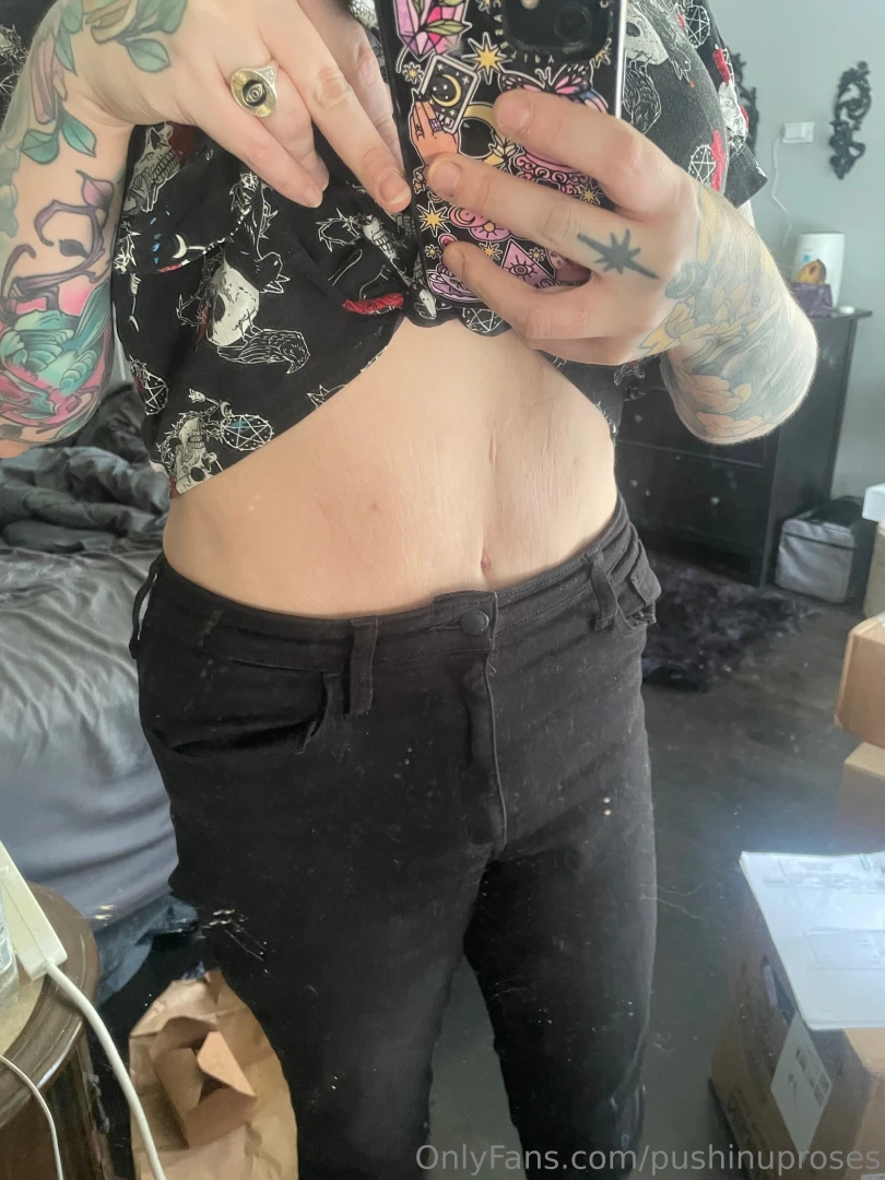 Stretch marks scars loose skin - i have them all and it took me so 