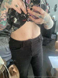 Stretch marks scars loose skin - i have them all and it took me so