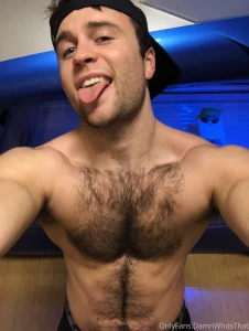 Hairy boy