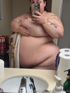 My stretch marks are so red