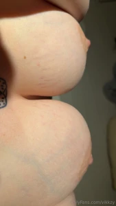 Arggg i ve gotten so many new stretch marks in the most visible place part 1