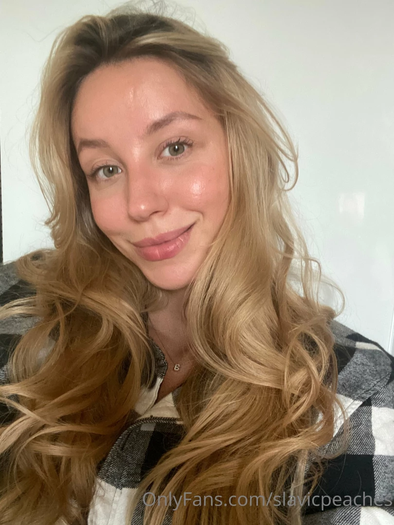 Somebody was under the sun for too long that s why red face ahaha 