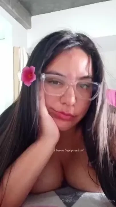 With a pimple on my forehead but i still look beautiful 