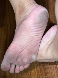 My soles today dry weather makes my soles looks more callous part 1