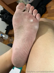 My soles today dry weather makes my soles looks more callous part 8