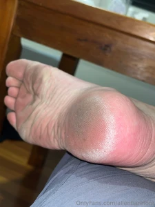 My feet after riding motorcycle part 1