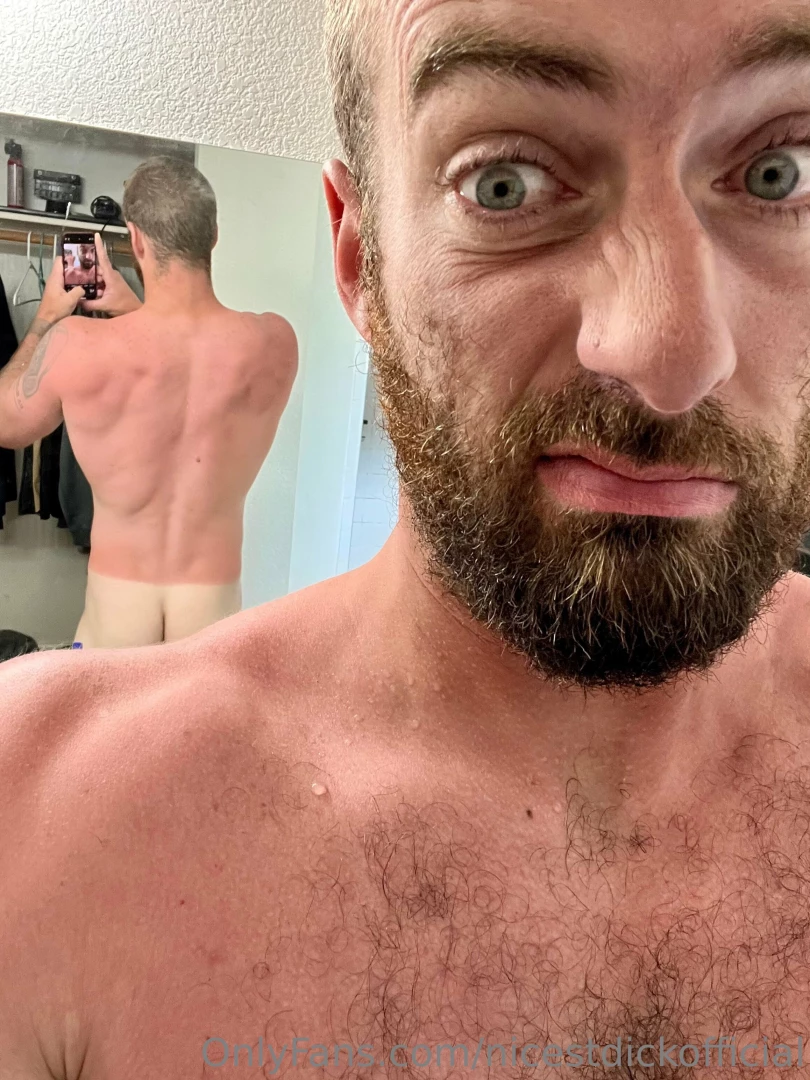 You wanna come rub some aloe on me 