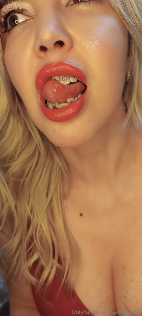 Do you want to lick my braces 