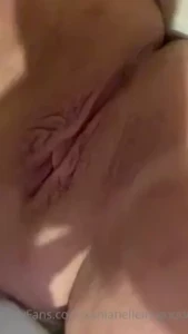 First videos after my car accident sorry i ve been mia had a very part 2