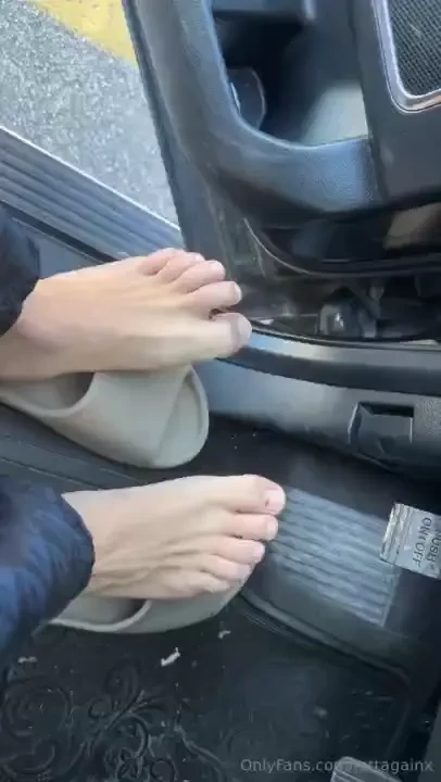 I swear this toe has only not had a bruise like 2 months out of the 