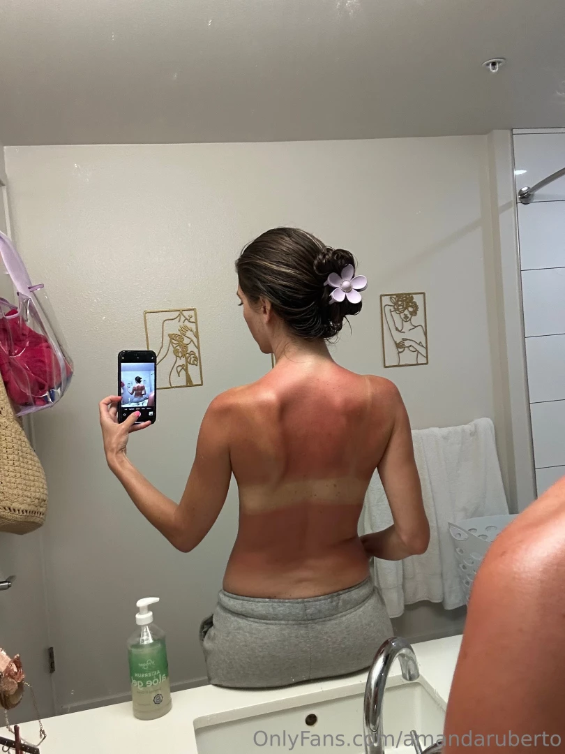 Omg i burned my back but the front s still hot tan lines peeking aloe 