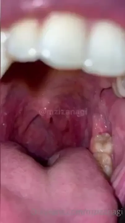 Swipe for mouth tour you like staring at my mouth why don t you take a part 2 