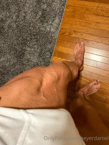 Leg veins