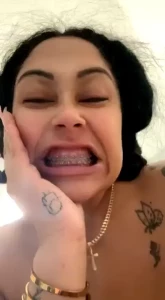 My braces will be gone soon