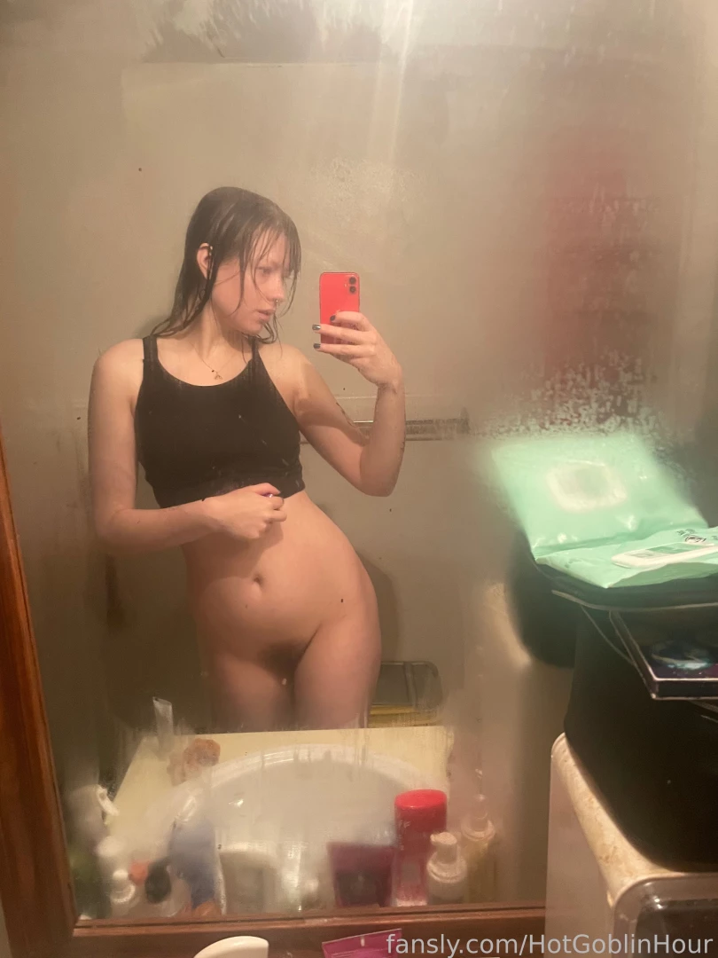 Hey guys i had a moderate psoriasis flare up on my ribs and back it part 1 