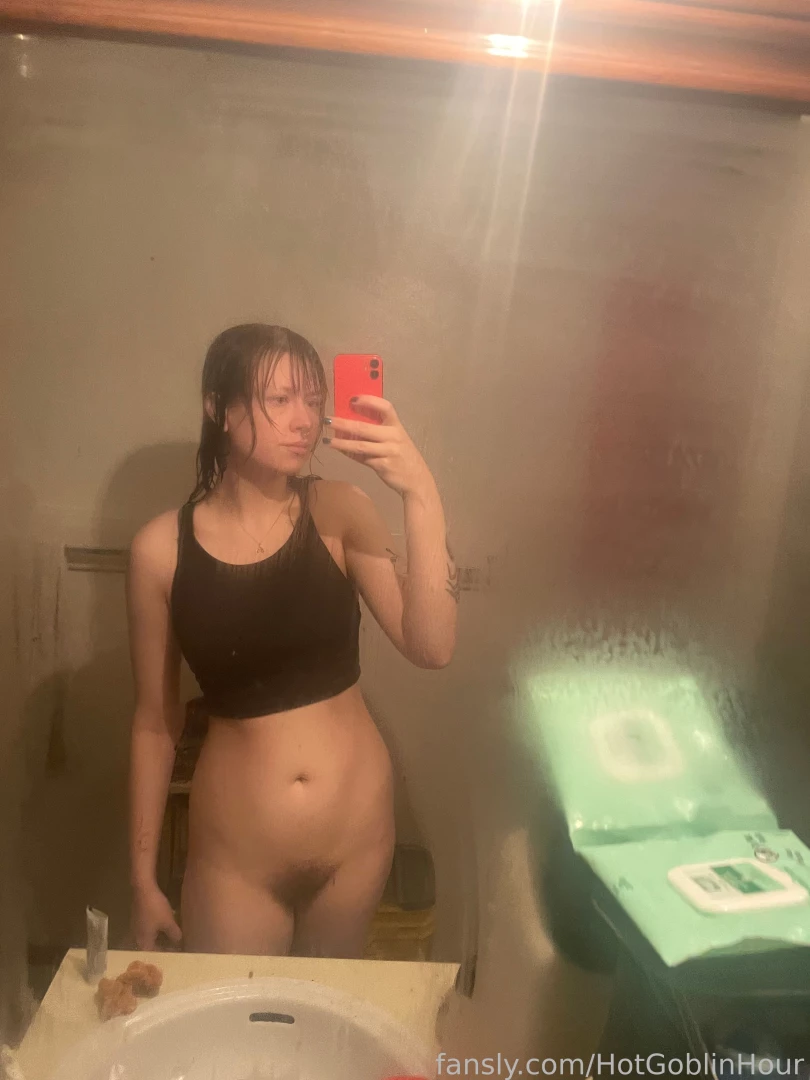 Hey guys i had a moderate psoriasis flare up on my ribs and back it part 3 