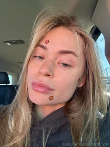 This face stickers are supposed to cover and cure pimples now i dont