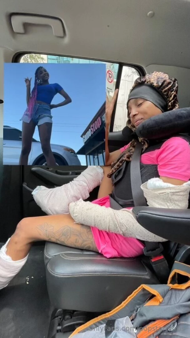 Transparency post pic 1 before the accident pic 2 after all my part 1 