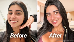 First time doing baby botox in today s video i m taking the plunge