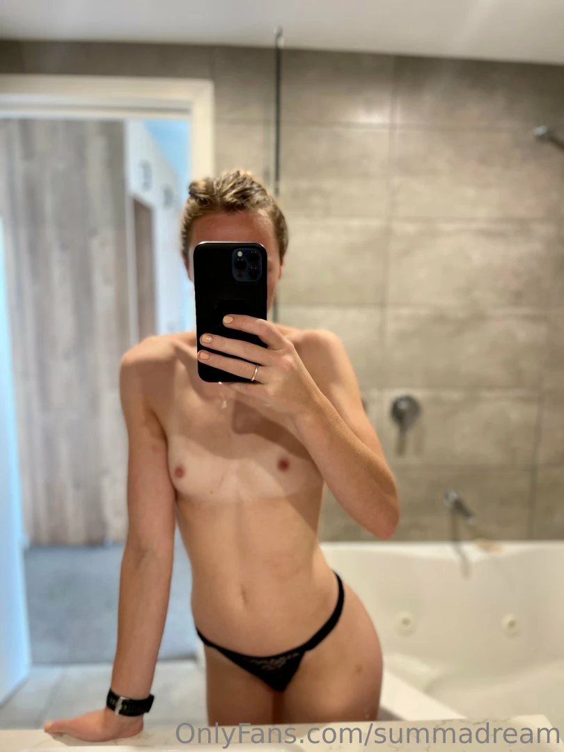 Don t mind the little bruise on my leg part 1 