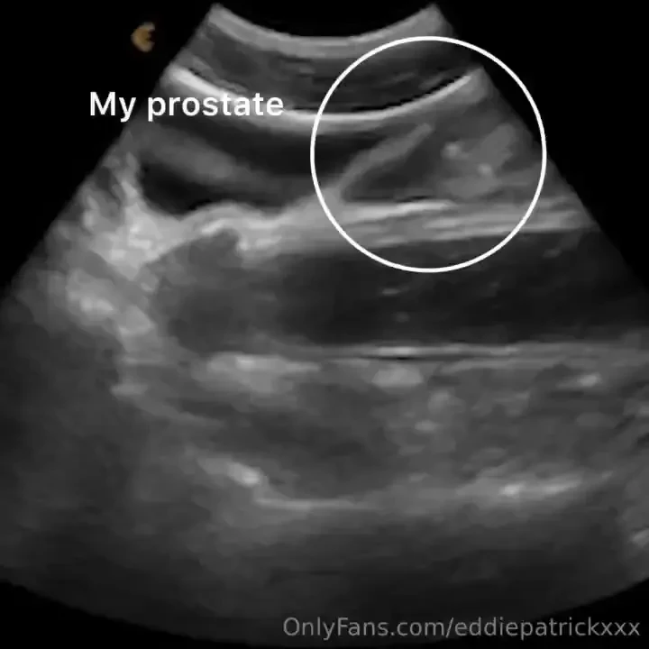 My ultrasound appointment with dr wolf now available presale imagine a part 2 