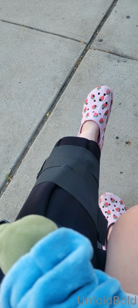 So guys i got hit by a car today in my wheelchair heading to physical part 3 