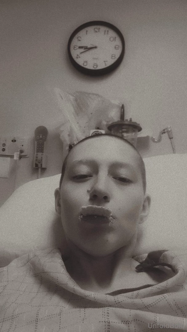 Here s a pic of me eating a cracker for my update yes i lost my hair 