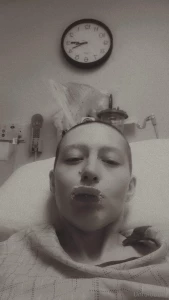 Here s a pic of me eating a cracker for my update yes i lost my hair