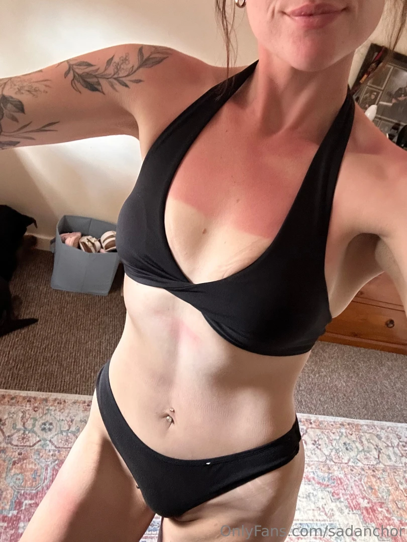 I got crazy burnt biking around rottnest and it s genuine pain part 1 