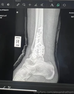 Hey everyone just wanted to check in with a quick update and say part 1