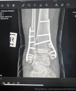 Hey everyone just wanted to check in with a quick update and say