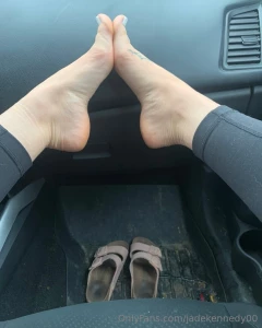 Birkenstocks are perfect for my high arches