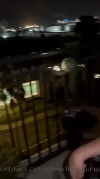 After we hooked up lol he gave me the worst lip hickey i ve ever had 