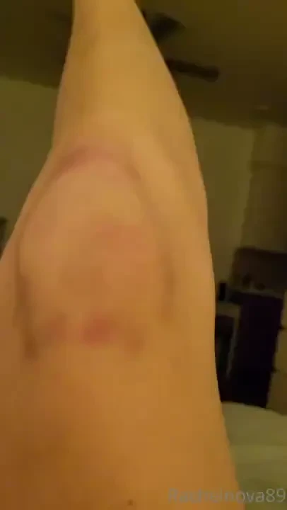 So many bruises on my knees and not from sucking too much cock 