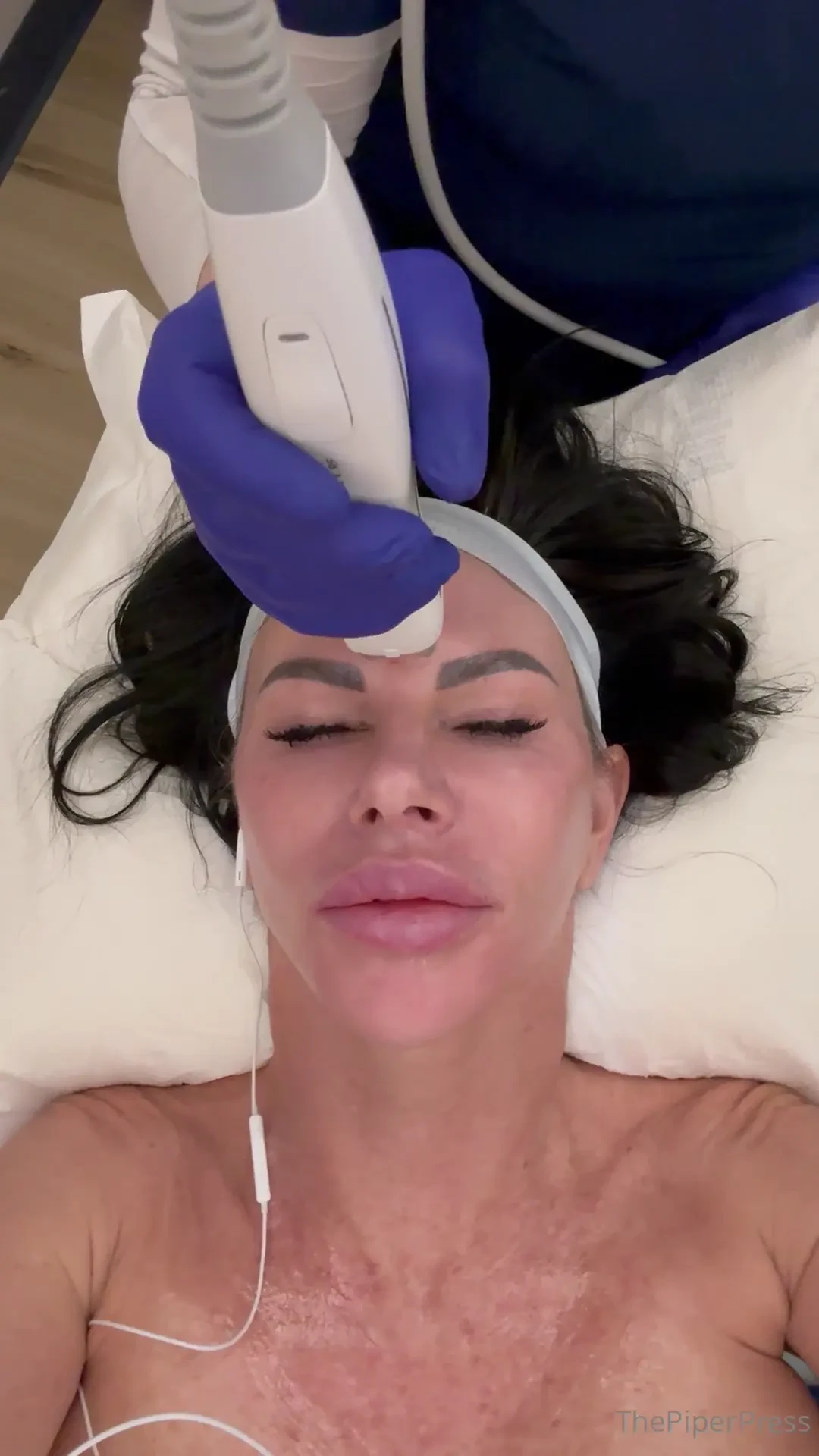 Piper daily updates sharing part of my day crazy lazer facial good for part 2 