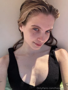 Freckles are small pigmented spots on the skin that most often appear