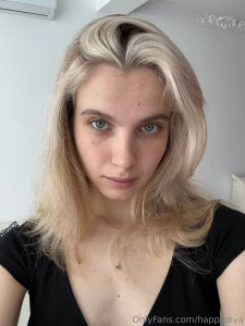 Freckles are small pigmented spots on the skin that appear in people