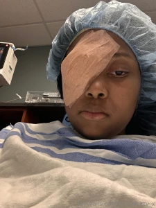 Just getting out of surgery