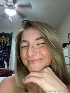 Freckle face for lyfe