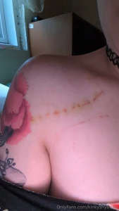 It finally bruised today