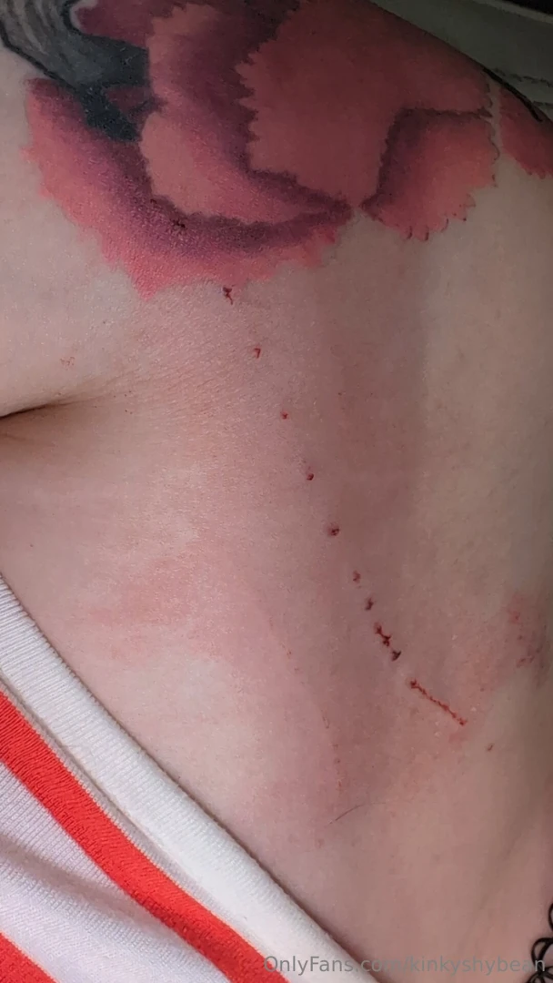 Small pause on spicy content making as i ve been injured so any posts part 1 