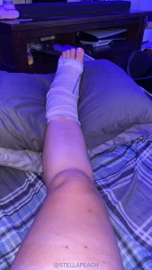 Hey daddies and baddies sorry i ve been mia i finally had my emergency part 2