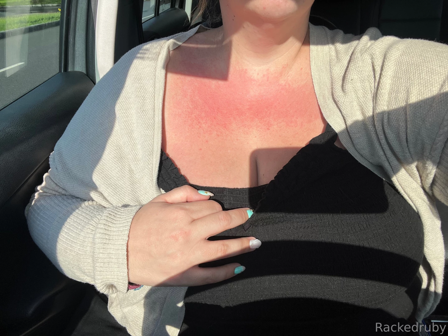 Okkkk sooooo thag body oil gave me a super nice rash send tips on 