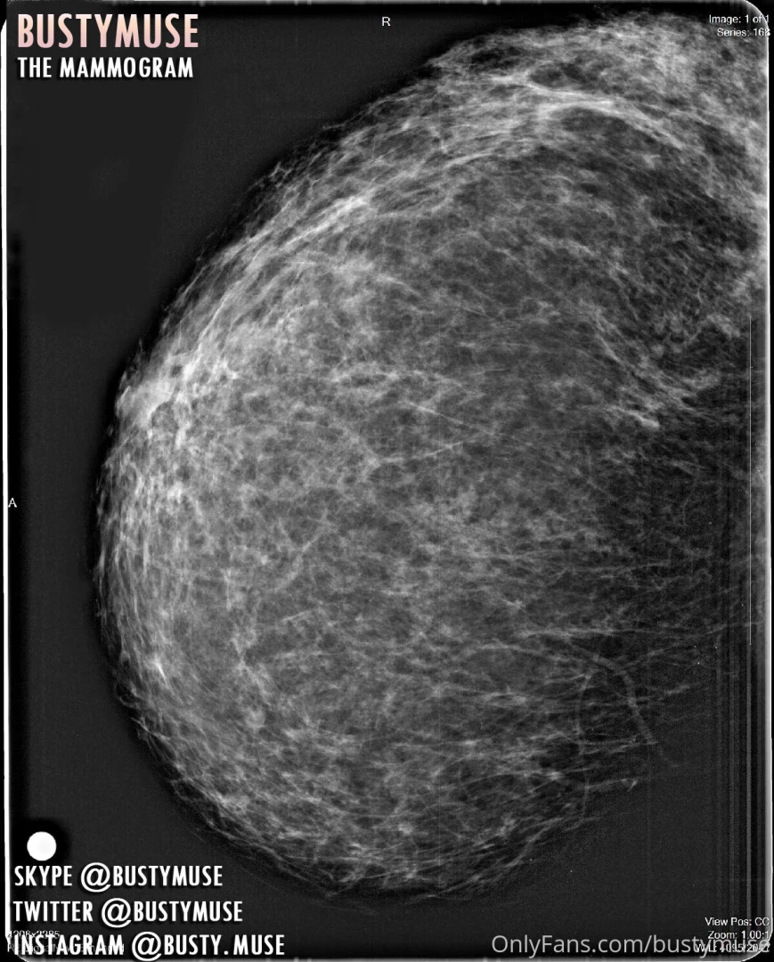 Finally you can see my mammogram the mammographer had been doing her 